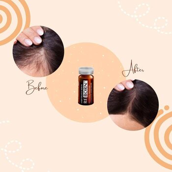 Sunki Hair Follicle Reborn Serum (BTCNS?)  30ml